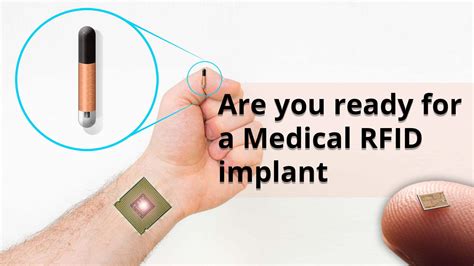 human rfid chips 2015|can you microchip a person.